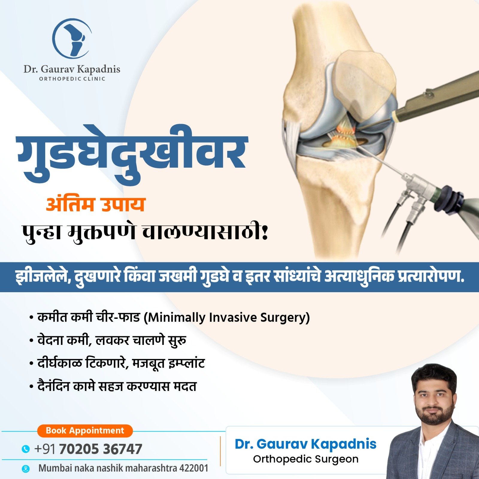 Knee Replacement in Nashik by Dr. Gaurav Kapadnis showing advanced minimally invasive knee surgery for pain relief.